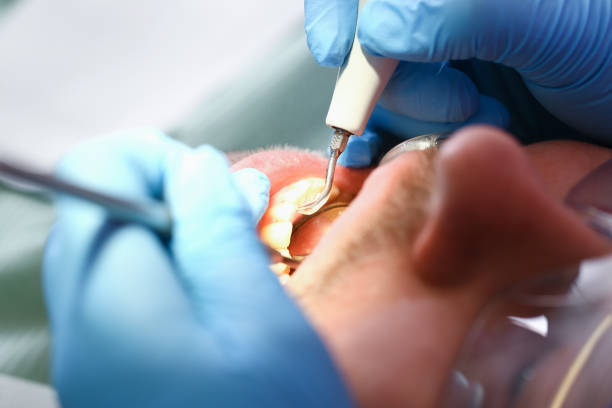 Professional Emergency Dentist in GA