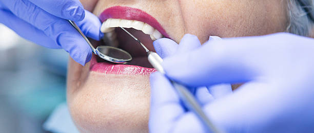 Best Emergency Tooth Extraction in Dawson, GA